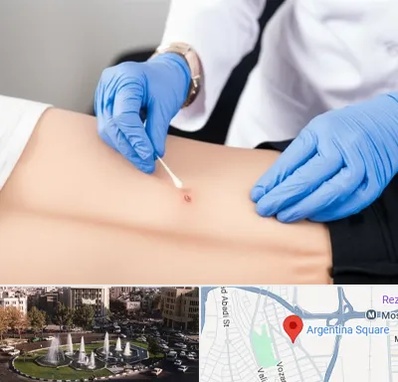 متخصص زخم بستر در آرژانتین