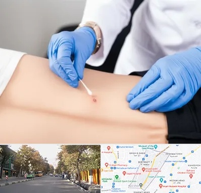 متخصص زخم بستر در شریعتی 