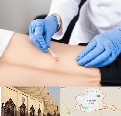 متخصص زخم بستر در ساوه