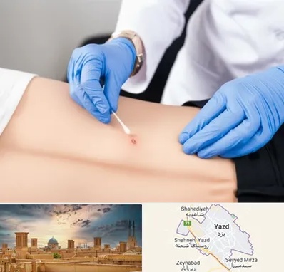 متخصص زخم بستر در یزد