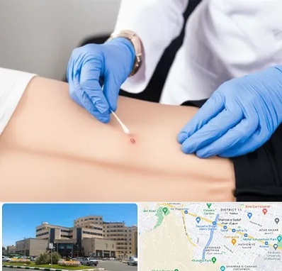 متخصص زخم بستر در صیاد شیرازی مشهد 