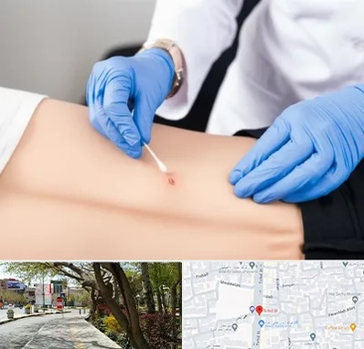 متخصص زخم بستر در خیابان توحید اصفهان 