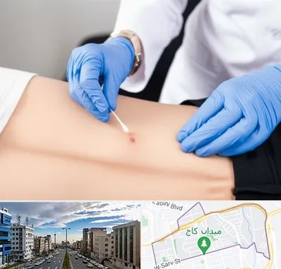 متخصص زخم بستر در سعادت آباد 