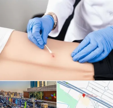 متخصص زخم بستر در لاله پارک تبریز 