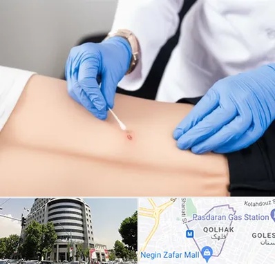 متخصص زخم بستر در قلهک 