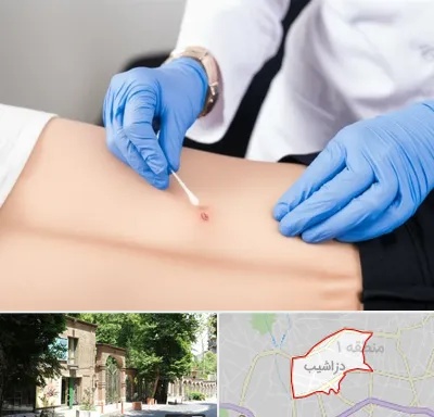 متخصص زخم بستر در دزاشیب