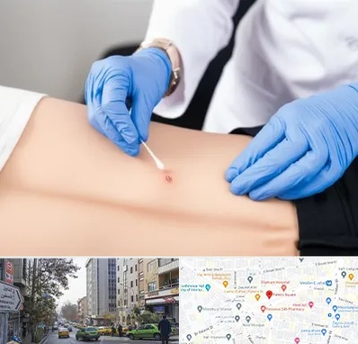 متخصص زخم بستر در فاطمی