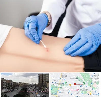 متخصص زخم بستر در بلوار فردوسی مشهد 