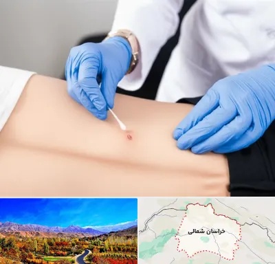 متخصص زخم بستر در خراسان شمالی