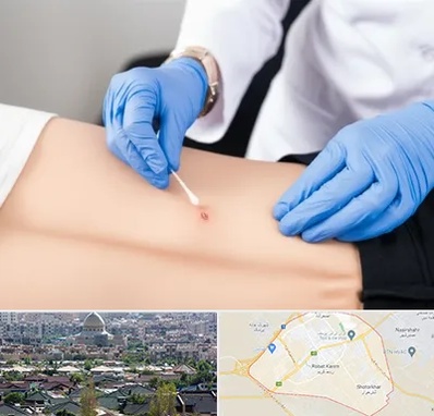 متخصص زخم بستر در رباط کریم