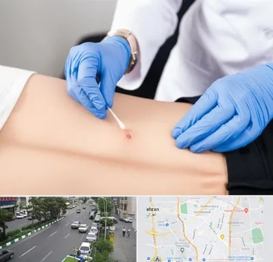 متخصص زخم بستر در ستارخان 