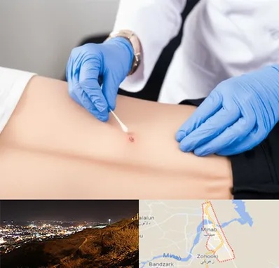 متخصص زخم بستر در میناب