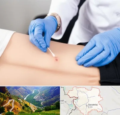 متخصص زخم بستر در کردستان