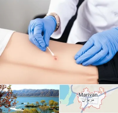 متخصص زخم بستر در مریوان