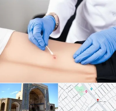 متخصص زخم بستر در مصلی مشهد 