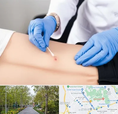 متخصص زخم بستر در قدوسی غربی شیراز 