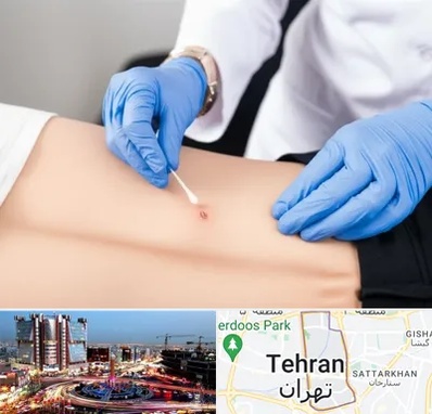 متخصص زخم بستر در صادقیه 