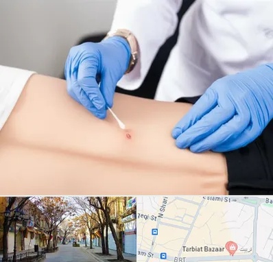 متخصص زخم بستر در تربیت تبریز 