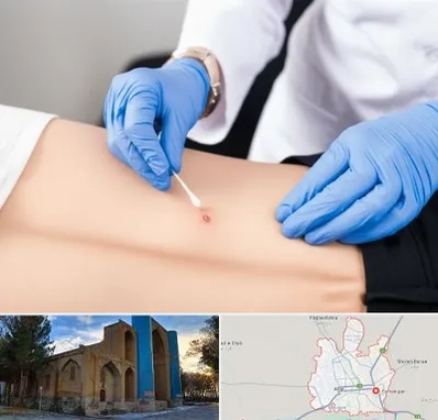 متخصص زخم بستر در اهر