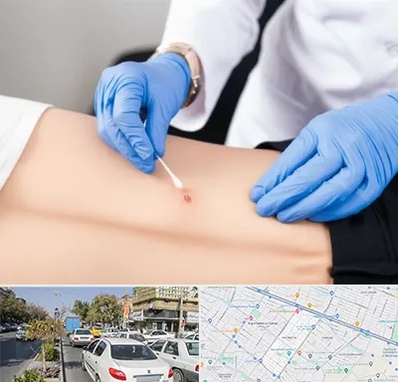 متخصص زخم بستر در مفتح مشهد 