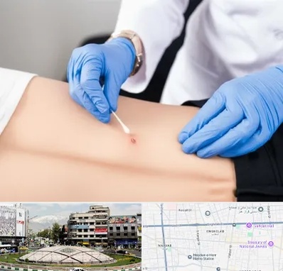 متخصص زخم بستر در مرکز تهران 