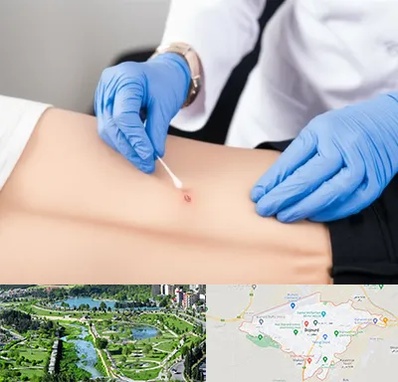 متخصص زخم بستر در بجنورد