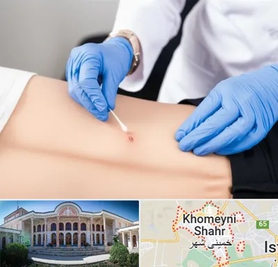 متخصص زخم بستر در خمینی شهر