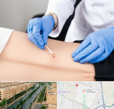 متخصص زخم بستر در فاز سه اندیشه