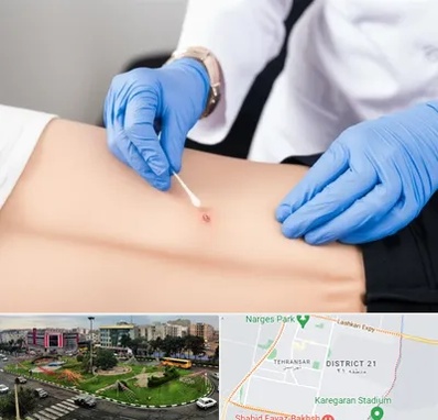 متخصص زخم بستر در تهرانسر 