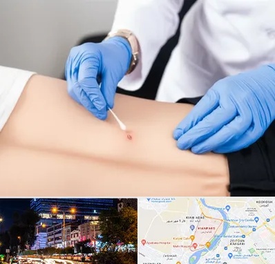 متخصص زخم بستر در کیانپارس اهواز 