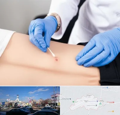 متخصص زخم بستر در ماهدشت کرج 