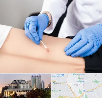 متخصص زخم بستر در فرشته 