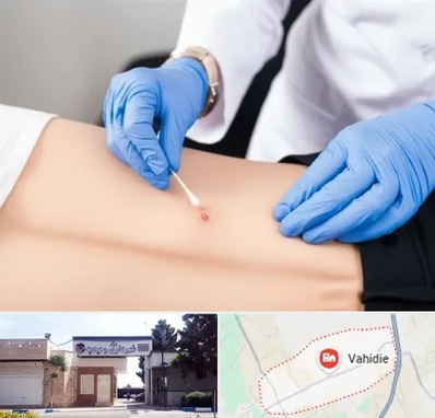 متخصص زخم بستر در وحیدیه شهریار