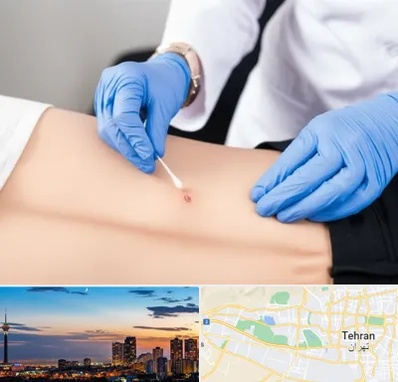 متخصص زخم بستر در غرب تهران 