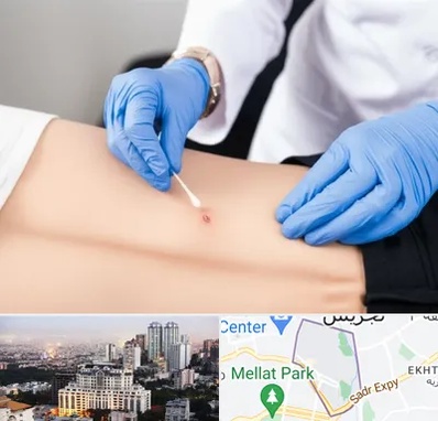 متخصص زخم بستر در الهیه 