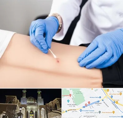 متخصص زخم بستر در زرگری شیراز 