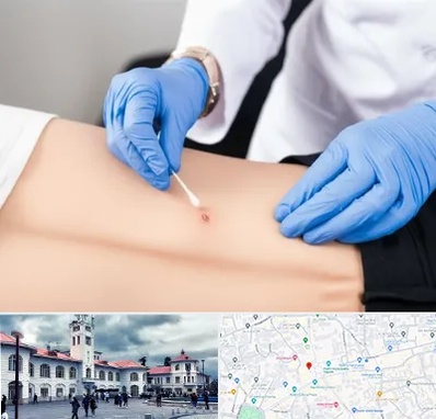 متخصص زخم بستر در میدان شهرداری رشت 