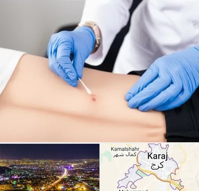 متخصص زخم بستر در کرج