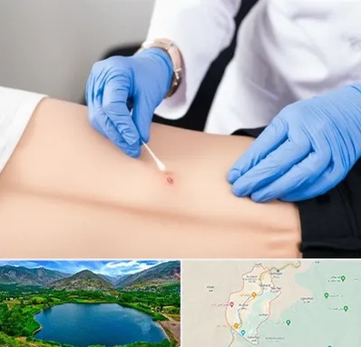 متخصص زخم بستر در رودبار