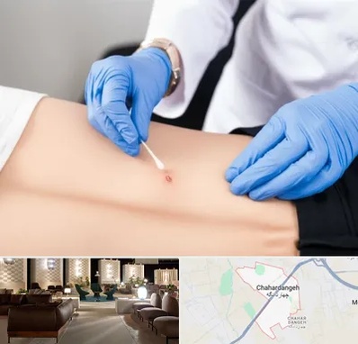 متخصص زخم بستر در چهاردانگه