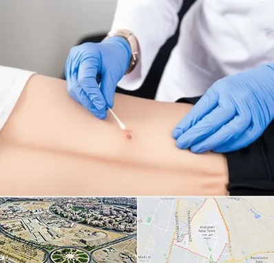 متخصص زخم بستر در اندیشه