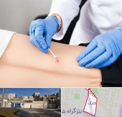 متخصص زخم بستر در اتابک