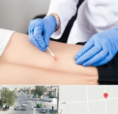 متخصص زخم بستر در هاشمی