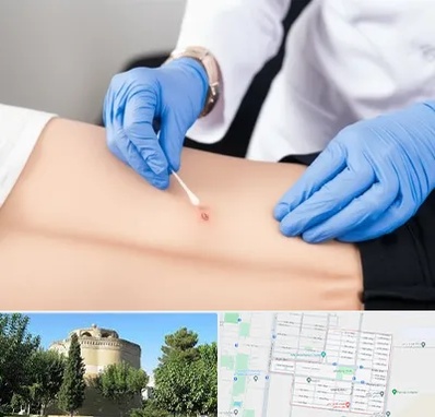 متخصص زخم بستر در مرداویج اصفهان 