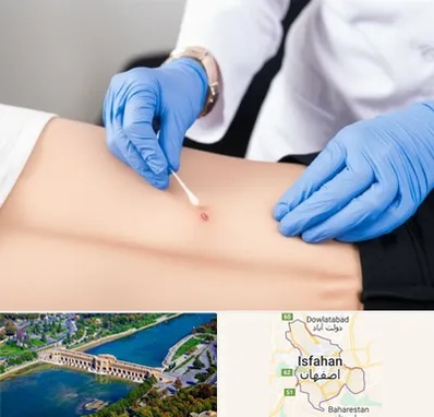 متخصص زخم بستر در اصفهان