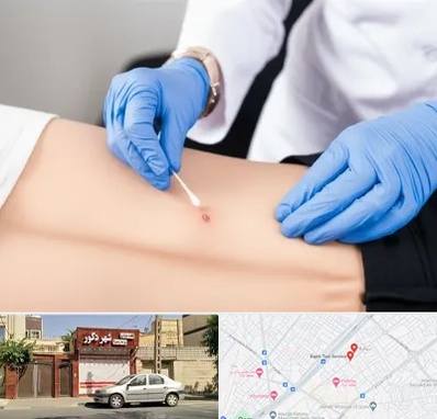 متخصص زخم بستر در باجک قم 