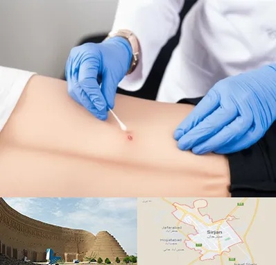 متخصص زخم بستر در سیرجان