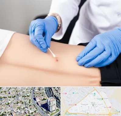 متخصص زخم بستر در قاسم آباد مشهد 