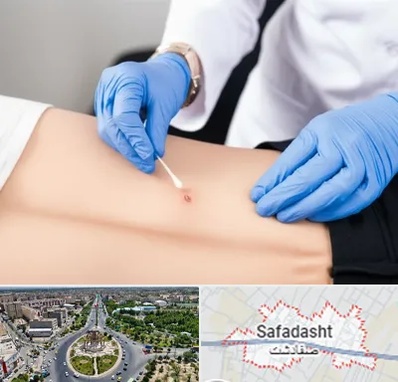 متخصص زخم بستر در صفادشت