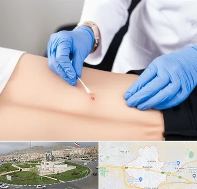 متخصص زخم بستر در بومهن